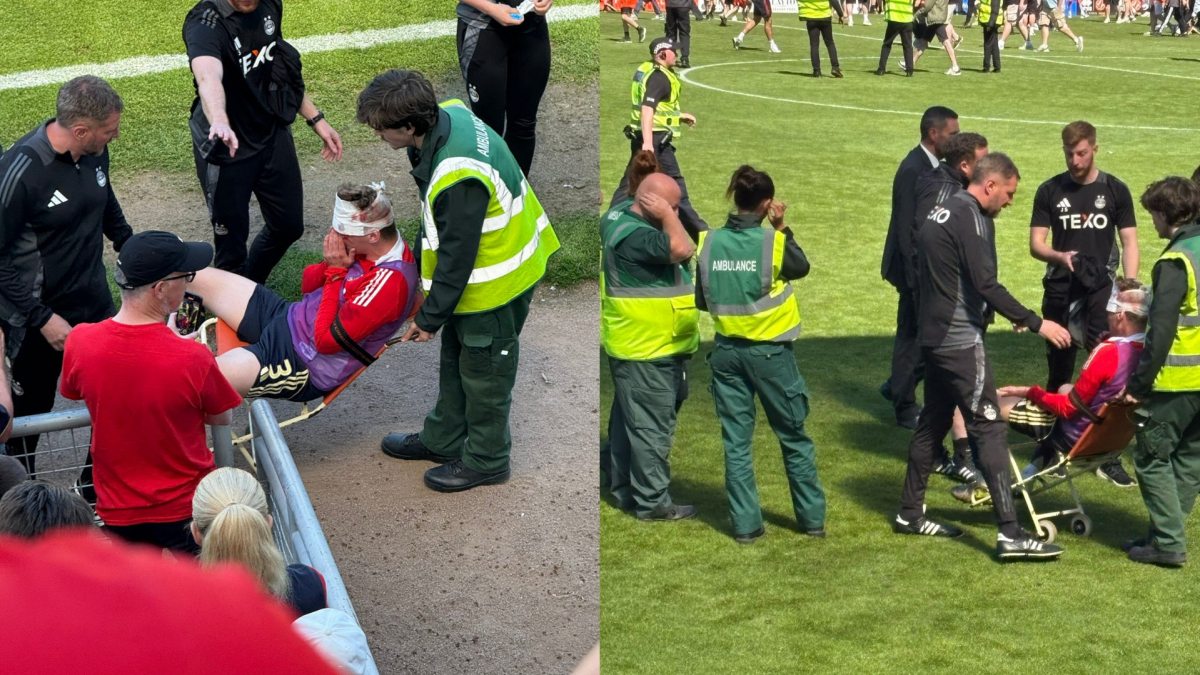 Cárcel para el aficionado que dejó "permanentemente desfigurado" a uno de sus jugadores tras golpearlo accidentalmente con una silla