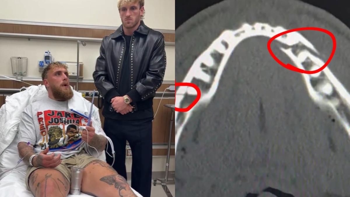 "Doble fractura en la mandíbula... Corazón y testículos intactos"