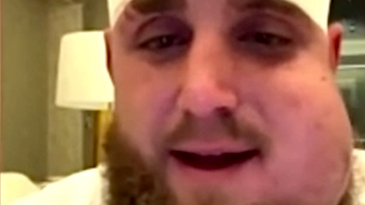 La escalofriante imagen de Jake Paul con la mandíbula rota por dos fracciones