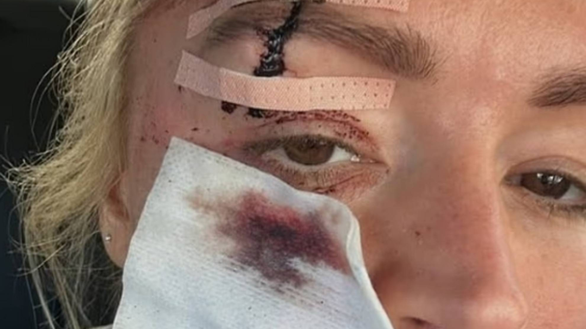 Famosa periodista deportiva, recuerda su accidente durante una cita romántica: "Los cortes llegaron hasta el hueso"