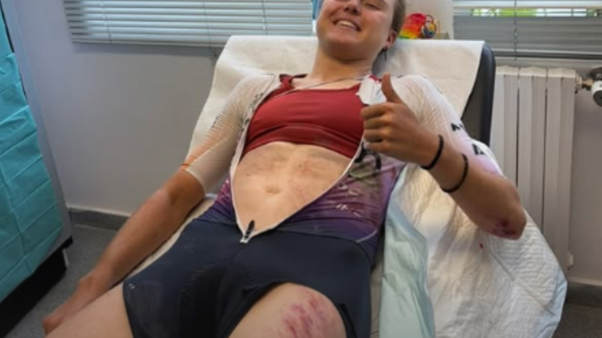 Susto para Paula Blasi: al suelo a más de 50 por hora… y de vuelta a la bici tras siete horas en el hospital
