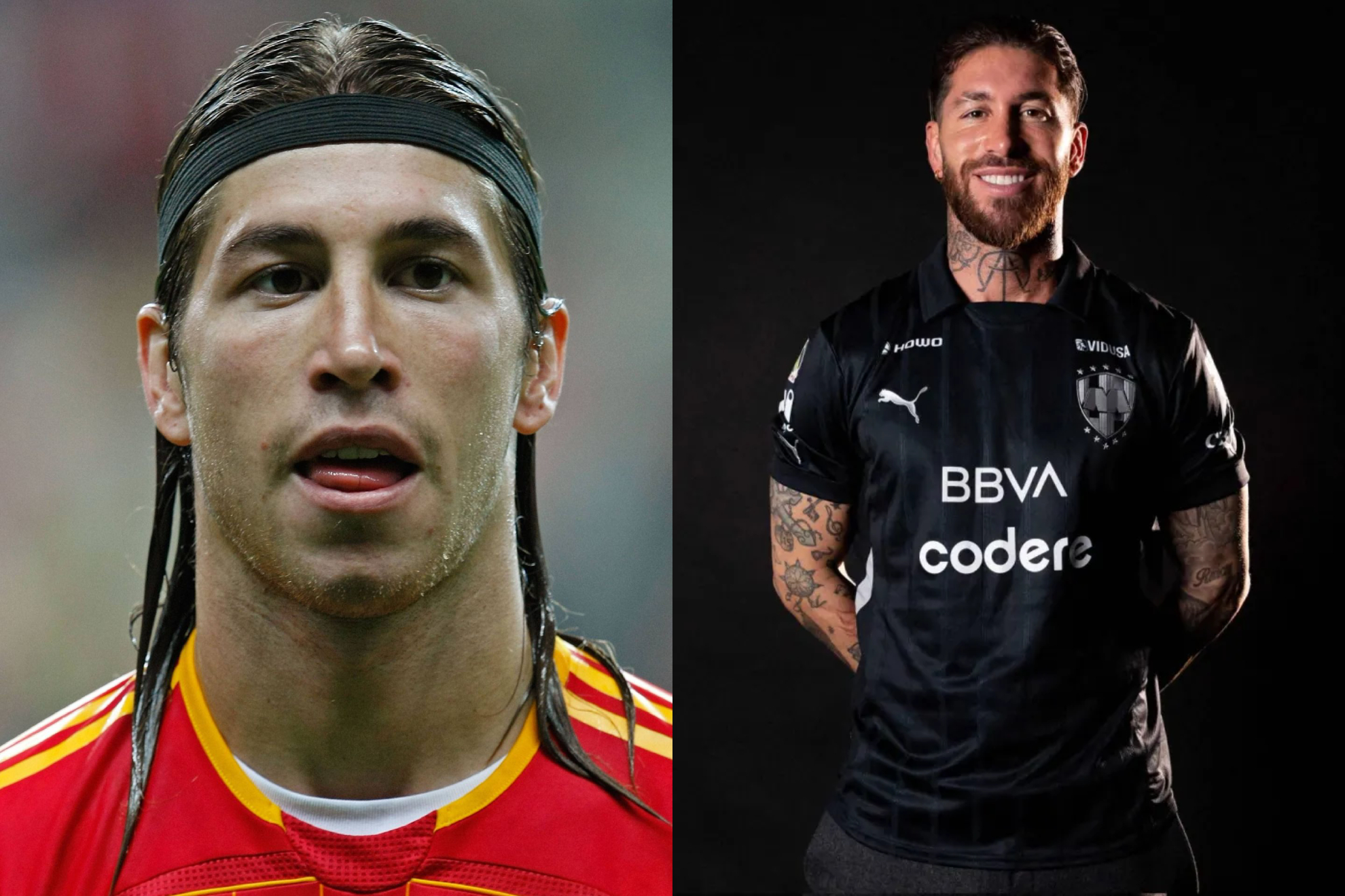 Sergio Ramos: bótox y armonización facial